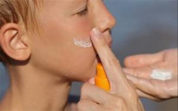 راهکاری موثر برای برطرف آفتاب سوختگی