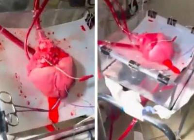ویدئوی شگفت انگیز از ضربان قلب در خارج از بدن پیش از پیوند